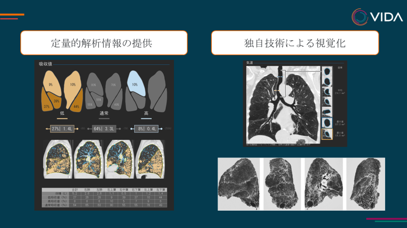 【本製品の解析後画像のイメージ図】